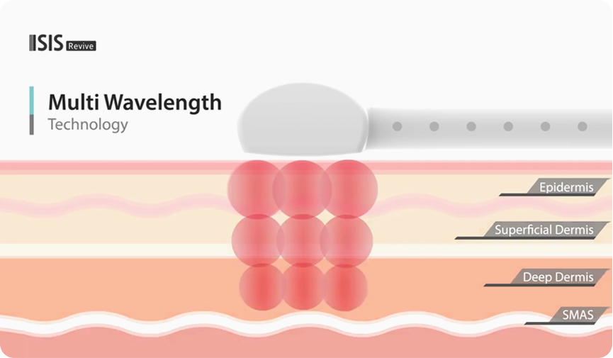 리비브 멀티웨이브 에너지 Multi Wavelength technology : revivie