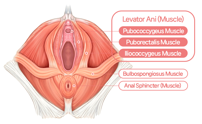 늘어진 인대를 강화하는 질 축소수술 Vaginal tightening surgery that strengthens loosened ligaments